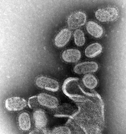 Virus gripe